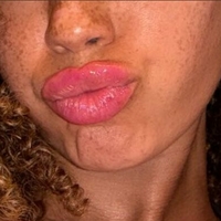 Абтеребел Оголені