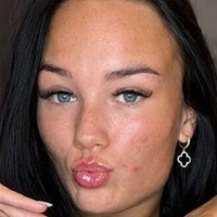 Алексісборедд Оголені