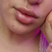 Бліксі Оголені