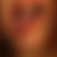 Дайга Корме Оголені