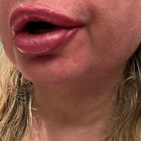 Ніна НортСтар Оголені