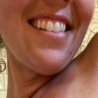 Снікінсалліфрі Оголені