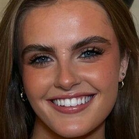 зарадезі Оголені